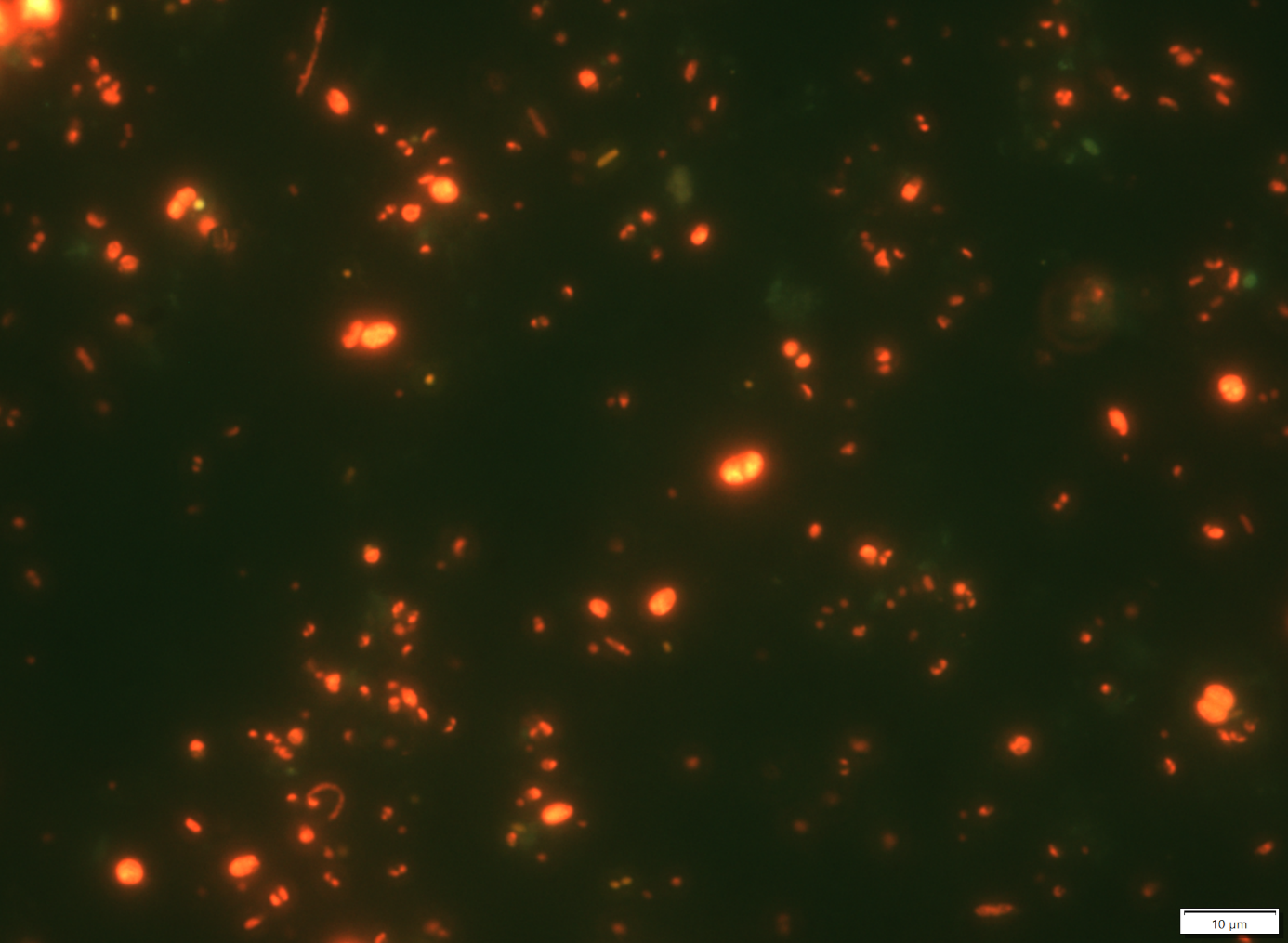 Pikoalga epifluoreszcens mikroszkópi fényképe