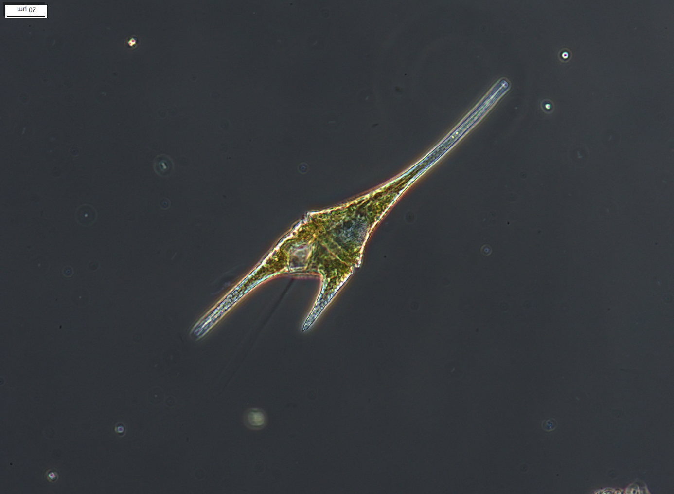 Ceratium furcoides mikroszkópi képe