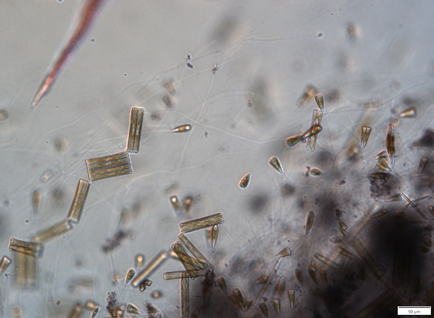 Láncszerűen kapcsolódó Diatoma vulgaris és a kocsonyanyélen ülő Gomphonema sp. kovaalga sejtjek a parti kövezést borító algabevonatban (Fotó Kovács Attila, 200x és 400x nagyítás)