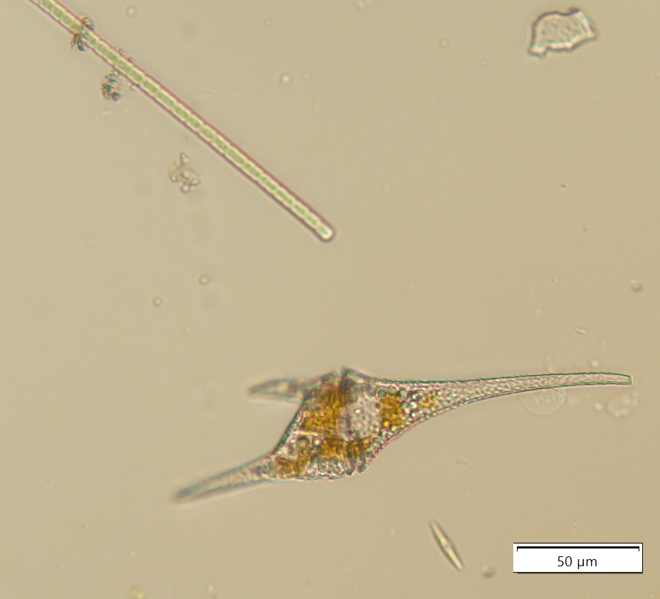Fecskemoszat és cianobaktérium fonal fénymikroszkópos képe