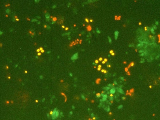 Sárga és piros autofluoreszcenciát mutató pikoalgák a Balaton planktonjában, a sejtek egy speciális mikroszkópi technika (epifluoreszcens mikroszkópia) segítségével tehetők láthatóvá