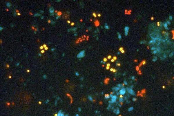 pikoalgák mikroszkópikus képe