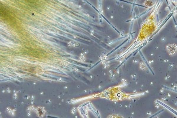 fonalas kékalga mikroszkópi képe