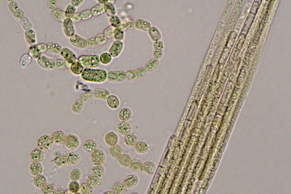 fonalas kékalga mikroszkópi képe